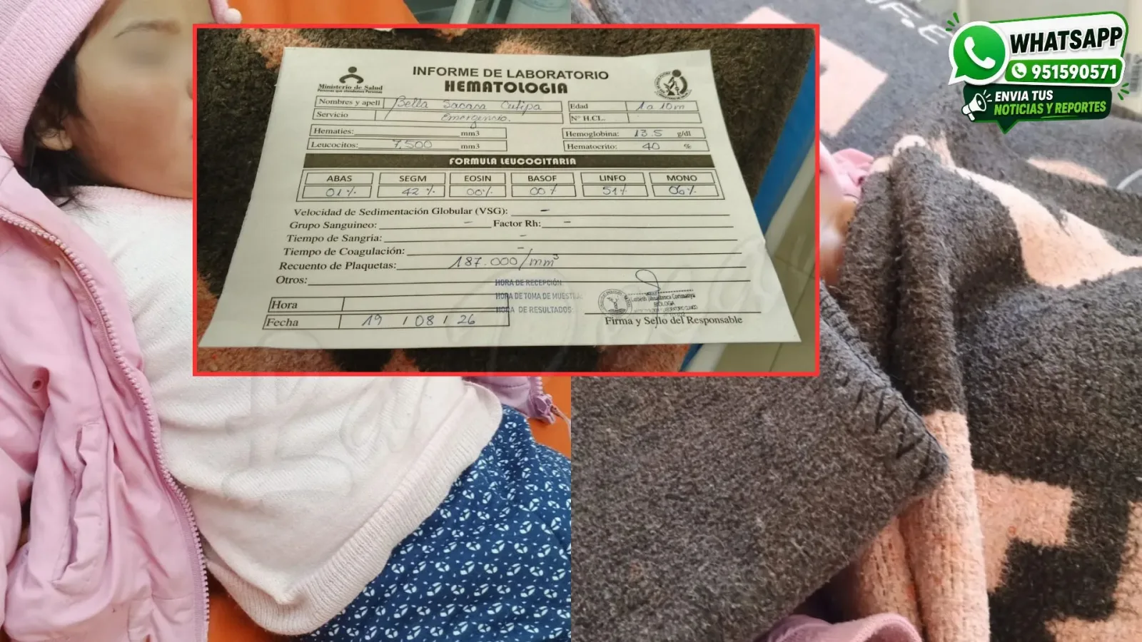 Siete menores ingresan a centro de salud tras presunta intoxicación en Cuna Más de Huayna Putina