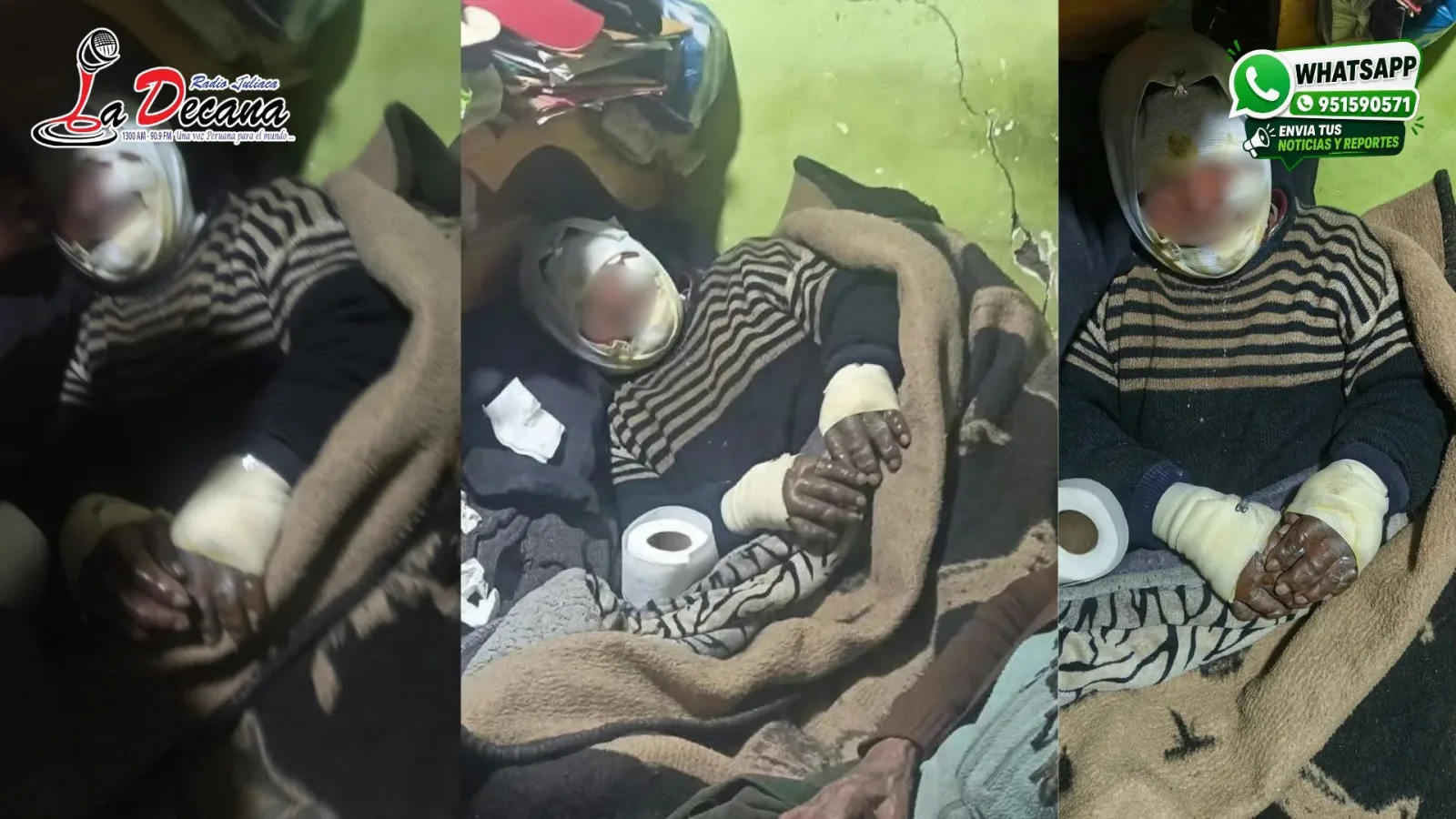 Un adulto mayor que sufrió quemaduras