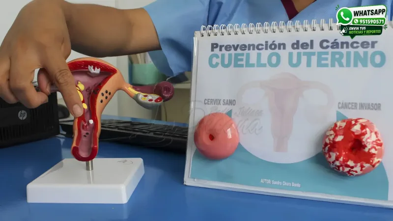 Cáncer-de-cuello-uterino